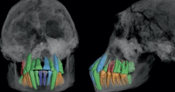 dientes fósiles