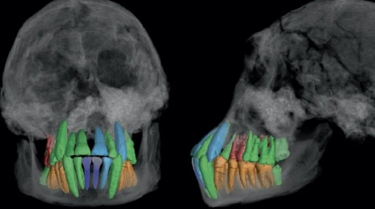 dientes fósiles